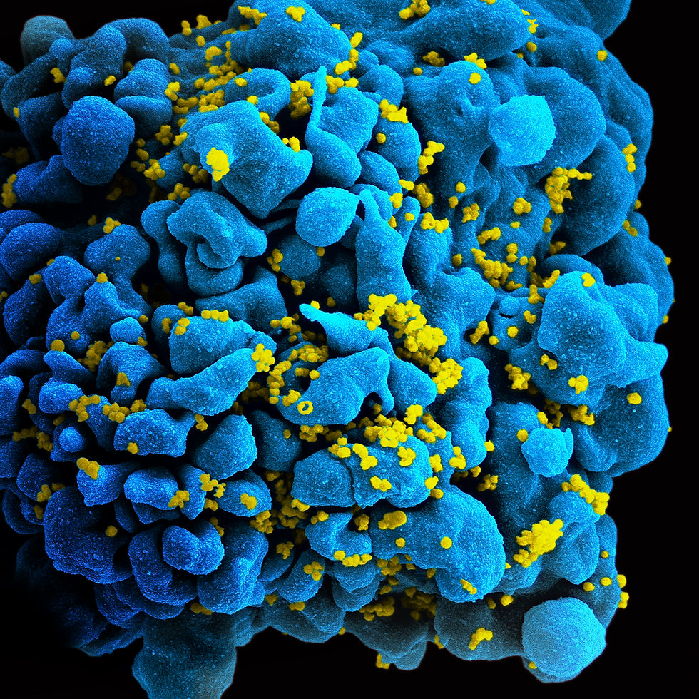 A colorized image of a white blood cell that has been infected with HIV.
